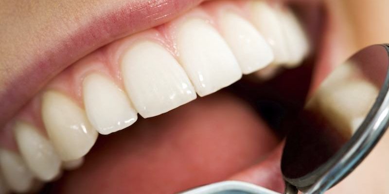 white-teeth-being-examined-by-dentist-800x400